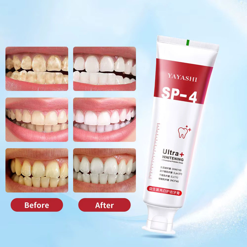 Yayashi SP4 Oral Care Probiotic Whitening Toothpaste 120g – Shine Brig ...